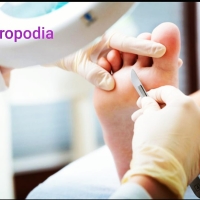 QUIROPODIA